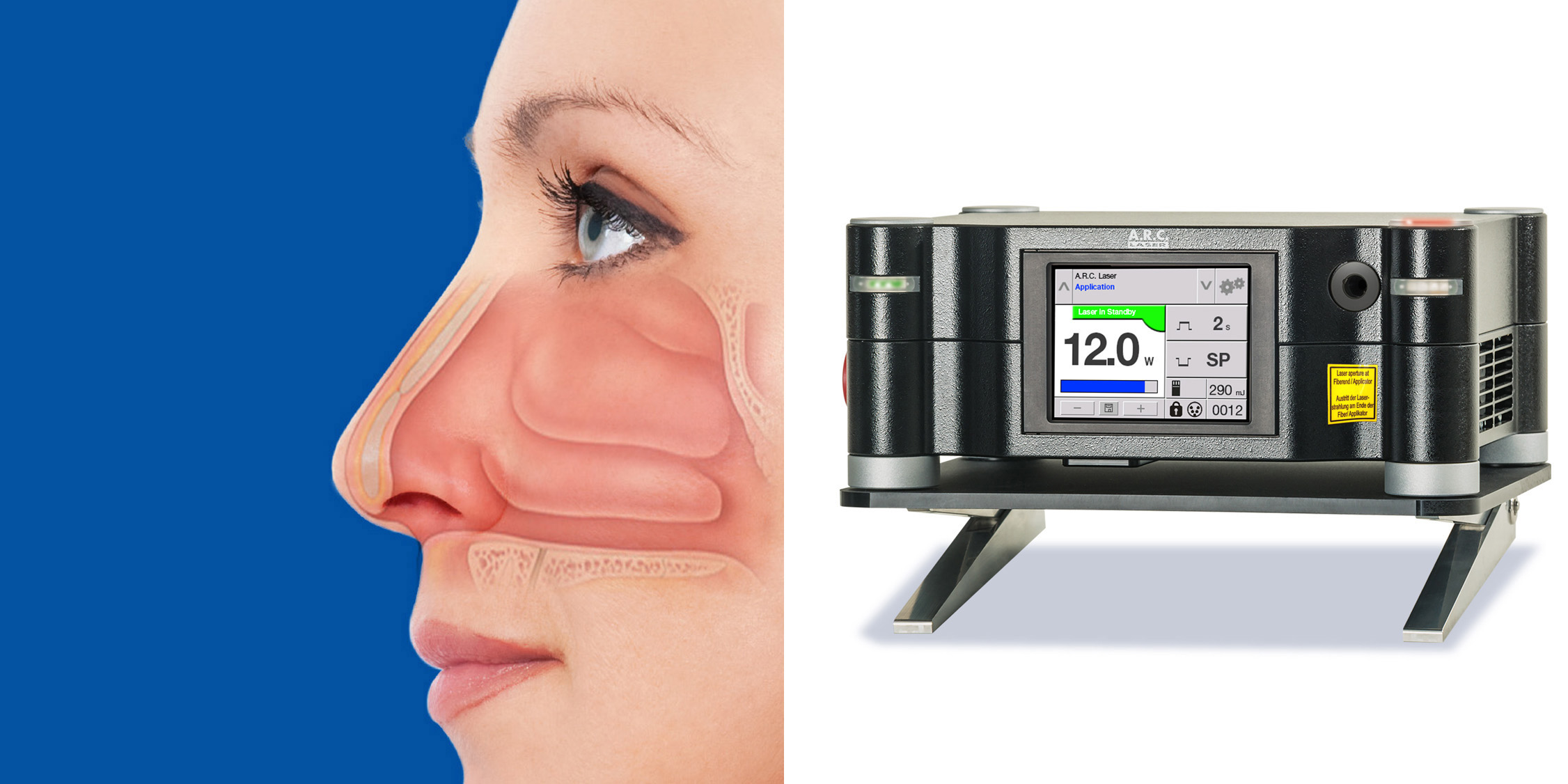 mhxanhma diodiko laser wolf-characteristics