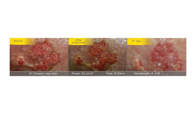 mhxanhma fwtotherapeias medisol-characteristics