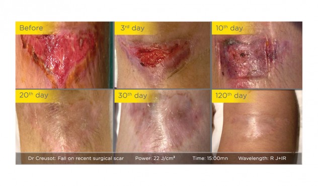 mhxanhma fwtotherapeias medisol-characteristics