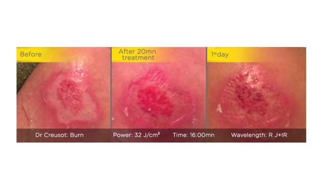 mhxanhma fwtotherapeias medisol-characteristics