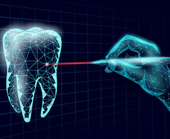 Τα πλεονεκτήματα της LASER Οδοντιατρικής