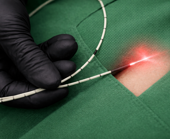 Διοδικό LASER 1470 nm στη γενική χειρουργική — Βελτιώνοντας αποτελέσματα σε κύστη κόκκυγος και πρωκτολογικές επεμβάσεις