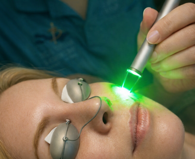 Αντιμετώπιση αγγειακών βλαβών με KTP LASER GBOX 532 nm