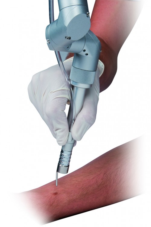 ΕΣΤΙΑΣΜΕΝΕΣ ΧΕΙΡΟΛΑΒΕΣ C-LAS